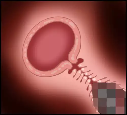 Install Core On Witches 18