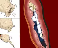 セルの丸呑み吸収